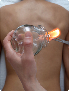 cupping therapy application demo
